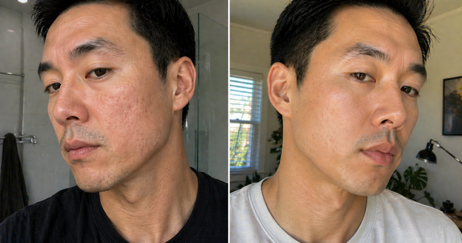 Marcus before and after 12 weeks on Hair Protocol