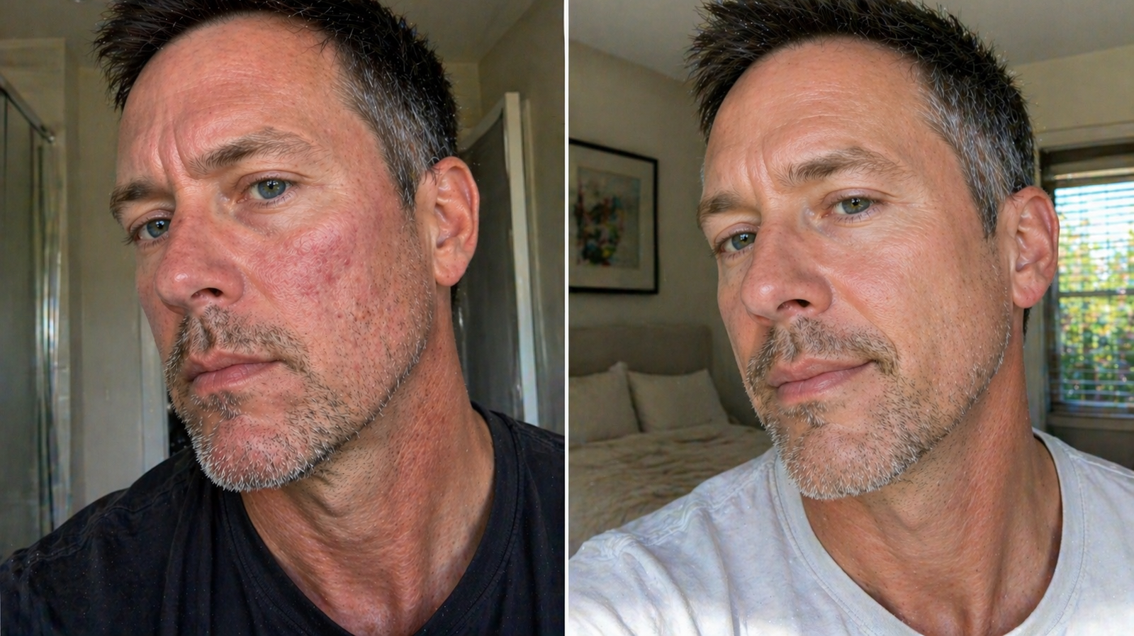 Darrell before and after 12 weeks on Hair Protocol