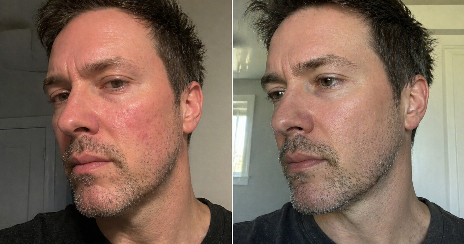 David before and after 12 weeks on Hair Protocol